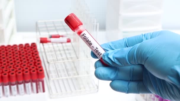 Φολικό Τεστ Για Ψάξουν Για Ανωμαλίες Από Αίμα Δείγμα Αίματος — Αρχείο Βίντεο