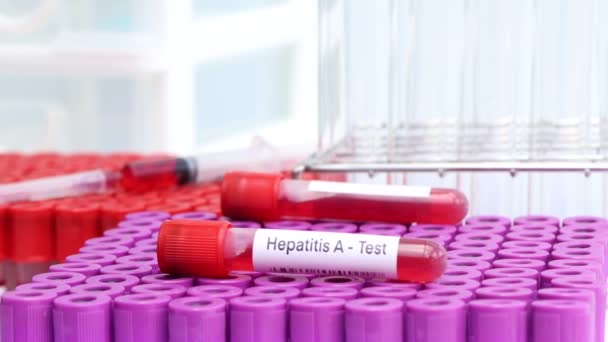Prueba Hepatitis Para Buscar Anomalías Sangre Muestra Sangre Para Analizar — Vídeo de stock