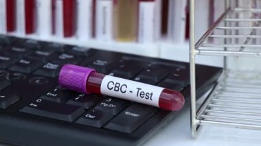Kan anormallikleri için tam kan sayımı testi laboratuvarda analiz edilecek kan örneği, test tüpünde kan.