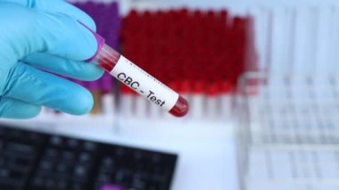 Kan anormallikleri için tam kan sayımı testi laboratuvarda analiz edilecek kan örneği, test tüpünde kan.
