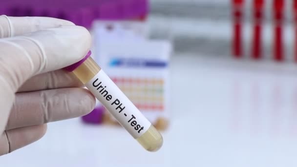 尿液Ph值检测以寻找尿液异常 尿样在实验室分析 尿液在试管中分析 — 图库视频影像