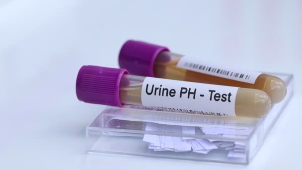 Urine Test Zoeken Naar Afwijkingen Van Urine Urine Monster Analyseren — Stockvideo