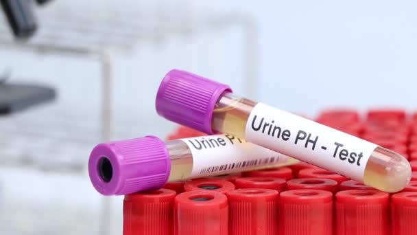 Teste Urina Para Procurar Anormalidades Urina Amostra Urina Para Analisar — Vídeo de Stock