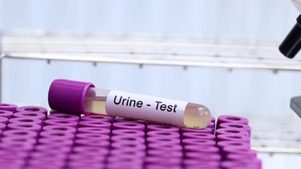 尿中の異常を調べる尿検査 尿中の分析サンプル 尿中の検査チューブ — ストック動画