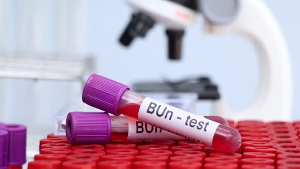 Bun Test Blood Blood Samples Analyzed Laboratory Red Blood Test — Αρχείο Βίντεο