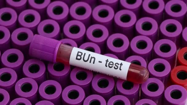 Bun Test Blood Blood Samples Analyzed Laboratory Red Blood Test — Video Stock