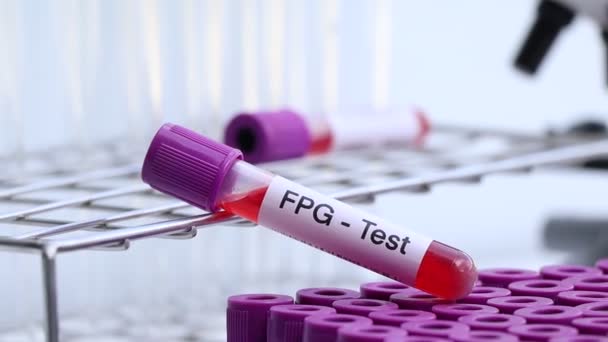 Fpg Test Blood Blood Samples Analyzed Laboratory Red Blood Test — стоковое видео
