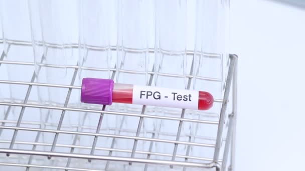 Fpg Test Blood Blood Samples Analyzed Laboratory Red Blood Test — Vídeo de stock