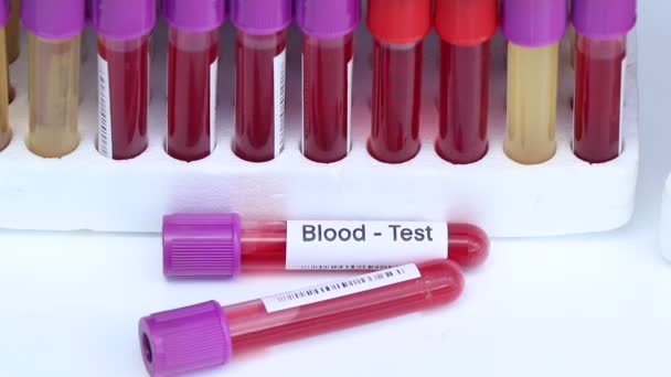 血液检查以查找血液中的异常情况 血液样品在实验室分析 血液在试管中 — 图库视频影像