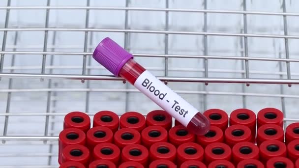 Εξέταση Αίματος Για Ψάξουν Για Ανωμαλίες Από Αίμα Δείγμα Αίματος — Αρχείο Βίντεο