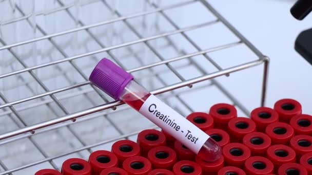肌酐检查检查血液中的异常情况 血样在实验室分析 血样在试管中 — 图库视频影像