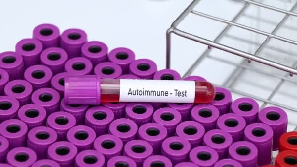 Autoimmume Teszt Keresni Rendellenességek Vér Vérminta Analizálni Laboratóriumban Vér Kémcsőben — Stock videók