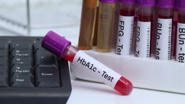 Hba1C Test Blood Blood Samples Analyzed Laboratory Red Blood Test — стоковое видео
