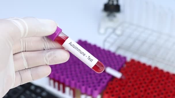 自体模体检查以查找血液中的异常情况 血样在实验室分析 血样在试管中 — 图库视频影像