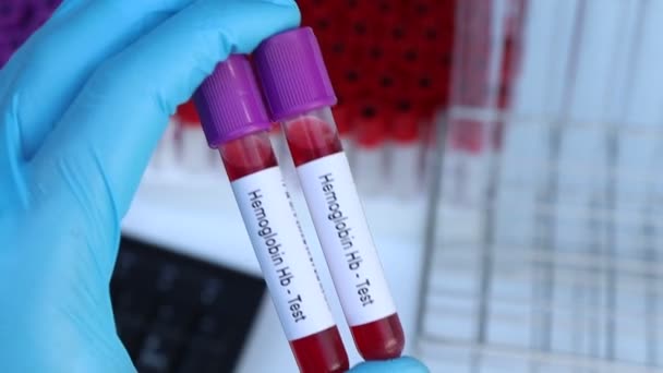 血红蛋白Hb检测从血液中检测异常 血样在实验室分析 血液在试管中检测 — 图库视频影像