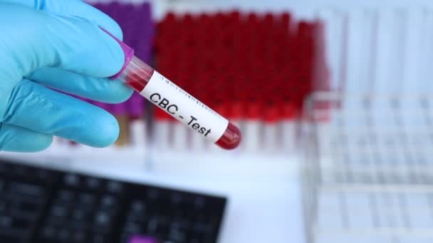 Cbc Δοκιμή Για Ψάξουν Για Ανωμαλίες Από Αίμα Δείγμα Αίματος — Αρχείο Βίντεο