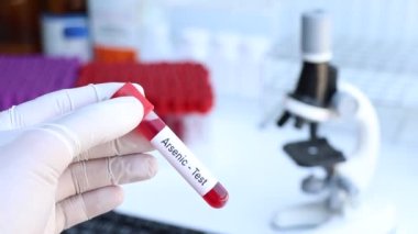 Kan anormallikleri için arsenik testi laboratuvarda analiz edilecek kan örneği, test tüpünde kan.