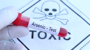 Kan anormallikleri için arsenik testi laboratuvarda analiz edilecek kan örneği, test tüpünde kan.