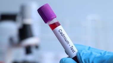 Kandaki anormallikleri araştırmak için kadmiyum testi laboratuvarda analiz edilecek kan örneği, test tüpünde kan.