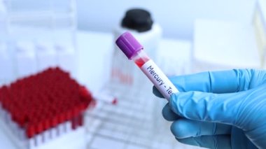 Kan anormallikleri için cıva testi laboratuvarda analiz edilecek kan örneği, test tüpünde kan.
