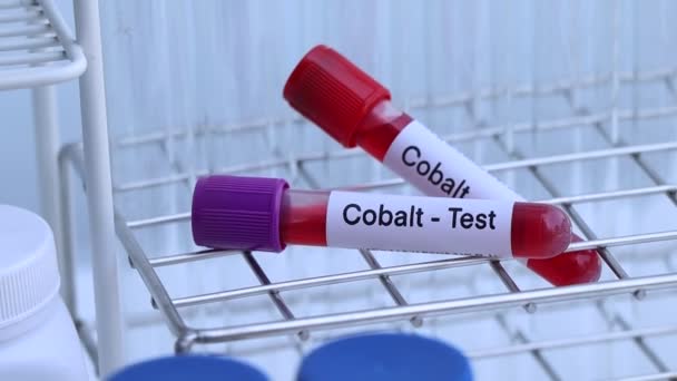 Kandaki Anormallikleri Araştırmak Için Kobalt Testi Laboratuvarda Analiz Edilecek Kan — Stok video
