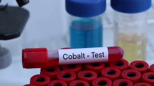 Test Cobalt Pour Rechercher Des Anomalies Sang Échantillon Sang Analyser — Video