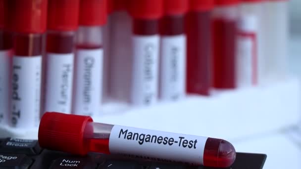 Manganese Cercare Anomalie Dal Sangue Campione Sangue Analizzare Laboratorio Sangue — Video Stock