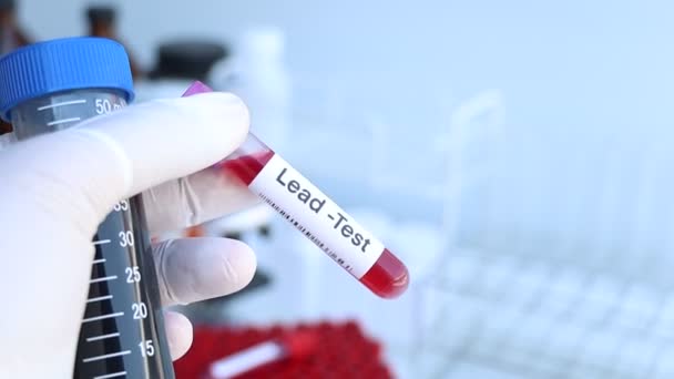 Teste Chumbo Para Procurar Anormalidades Sangue Amostra Sangue Para Analisar — Vídeo de Stock