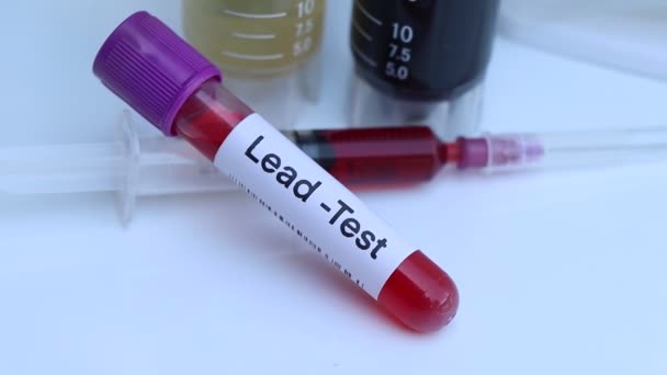Test Piombo Cercare Anomalie Dal Sangue Campione Sangue Analizzare Laboratorio — Video Stock