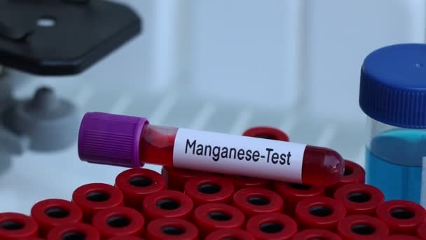 Mangaan Zoeken Naar Afwijkingen Van Bloed Bloedmonster Analyseren Het Laboratorium — Stockvideo