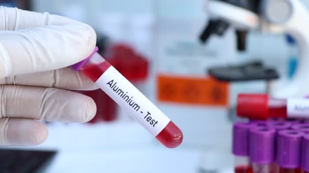铝检测检查血液中的异常情况 血样在实验室分析 血液在试管中检测 — 图库视频影像