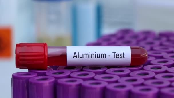 Aluminium Test Look Abnormalities Blood Blood Sample Analyze Laboratory Blood — Stock Video