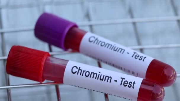Krom Testi Kandaki Anormallikleri Incelemek Için Laboratuarda Kan Örneği Test — Stok video