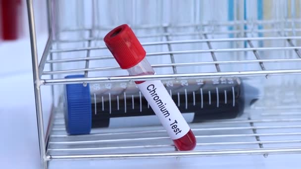 铬检测检查血液中的异常情况 血样在实验室分析 血液在试管中检测 — 图库视频影像