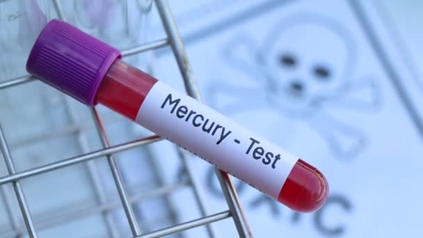 Mercury Test Look Abnormalities Blood Blood Sample Analyze Laboratory Blood — Stock Video