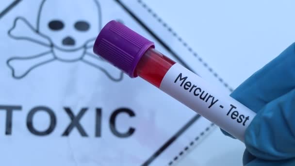 Mercury Test Hledat Abnormality Krve Vzorek Krve Analýze Laboratoři Krev — Stock video