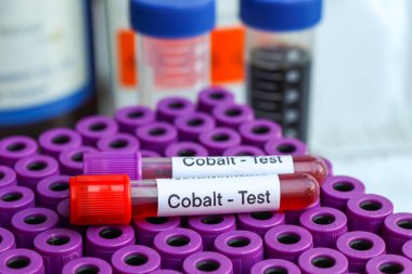 Kandaki anormallikleri araştırmak için kobalt testi laboratuvarda analiz edilecek kan örneği, test tüpünde kan.
