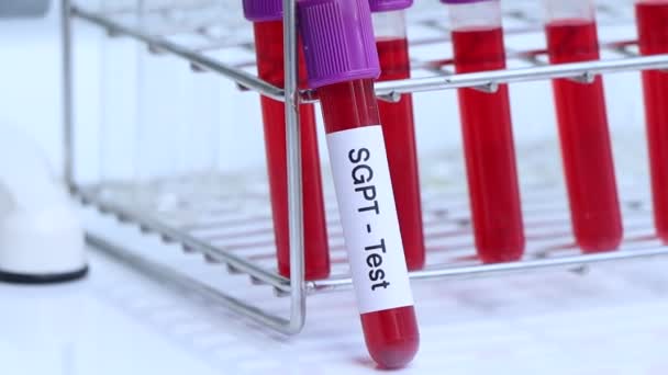 Test Sgpt Cercare Anomalie Dal Sangue Campione Sangue Analizzare Laboratorio — Video Stock