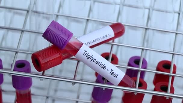 血液サンプルから研究室で分析する異常を探すためのトリグリセリド検査 検査管内の血液 — ストック動画