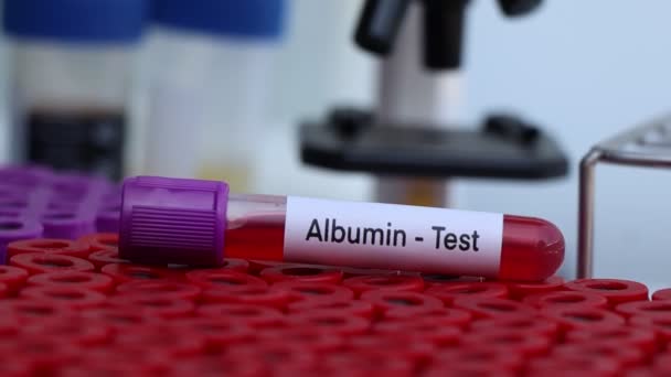 血液サンプルから研究室で分析する異常を探すためのアルブミン検査 検査管内の血液 — ストック動画