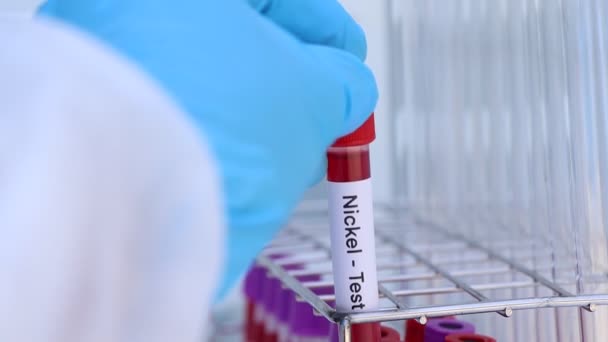 Тест Никель Наличие Аномалий Крови Анализ Крови Лаборатории Кровь Пробирке — стоковое видео