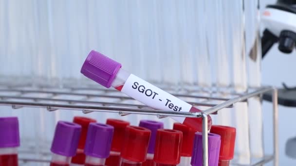 Тест Sgot Наличие Отклонений Крови Образец Крови Анализа Лаборатории Кровь — стоковое видео