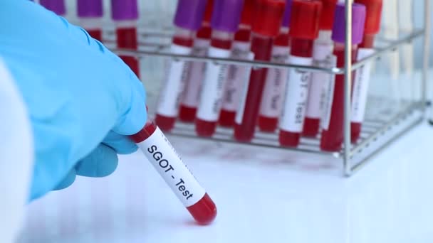 Examen Sgot Para Buscar Anormalidades Sangre Muestra Sangre Para Analizar — Vídeo de stock