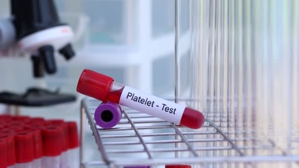 血小板検査では血液 血液サンプル 検査室での分析 検査管での血液などの異常を調べます — ストック動画