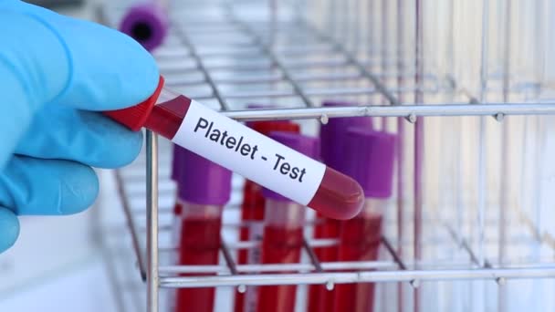 Blutplättchen Test Auf Auffälligkeiten Blut Blutprobe Zur Analyse Labor Blut — Stockvideo