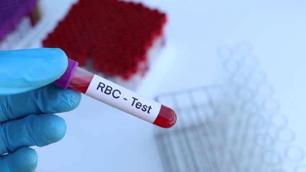 Test Rbc Pour Rechercher Des Anomalies Dans Sang Échantillon Sang — Video