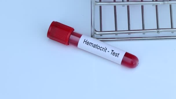 Hematocriet Test Kijken Naar Afwijkingen Van Bloed Bloedmonster Analyseren Het — Stockvideo