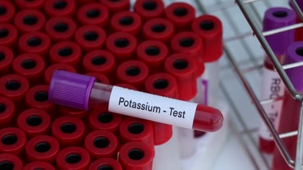 Teste Potássio Para Procurar Anormalidades Sangue Amostra Sangue Para Analisar — Vídeo de Stock