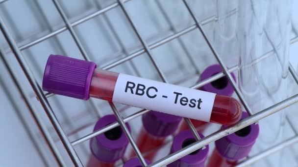 Teste Hemácias Para Procurar Anormalidades Sangue Amostra Sangue Para Analisar — Vídeo de Stock