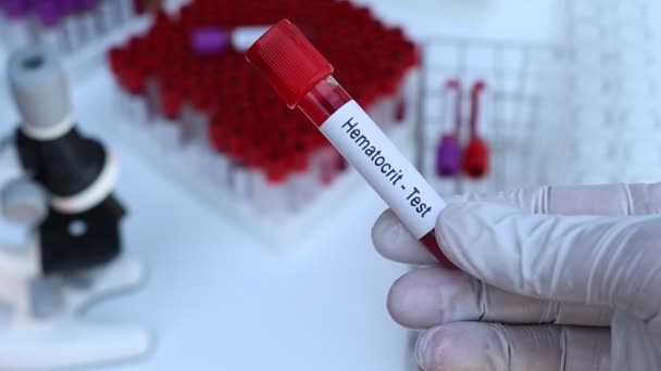 血压计检查从血液中检测异常 血样在实验室分析 血液在试管中检测 — 图库视频影像